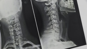X Ray Neck 23 2147612269 Copy