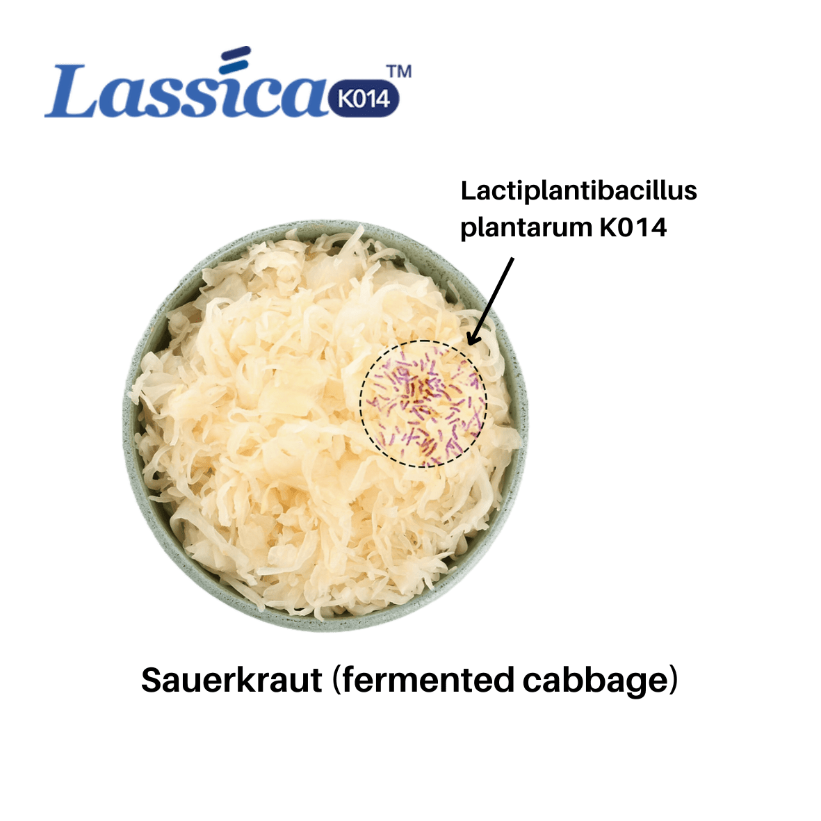 K014 Cabbage