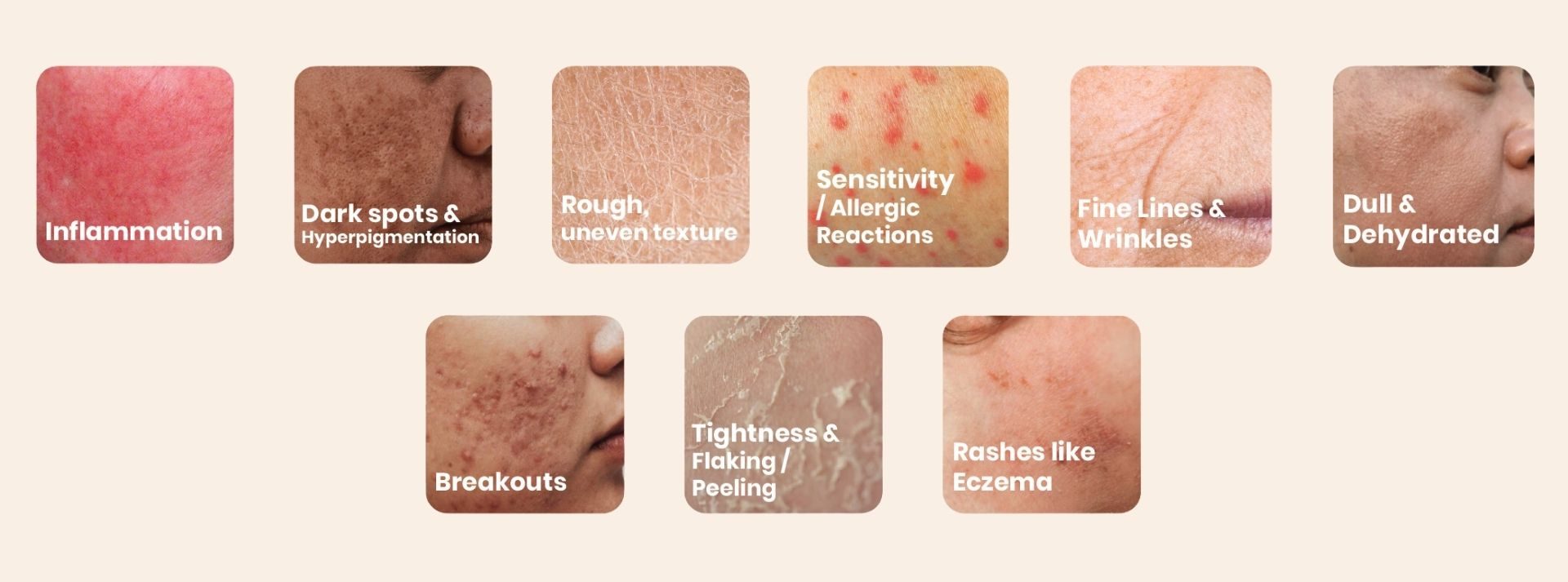 Signs Of Damaged Skin Barrier