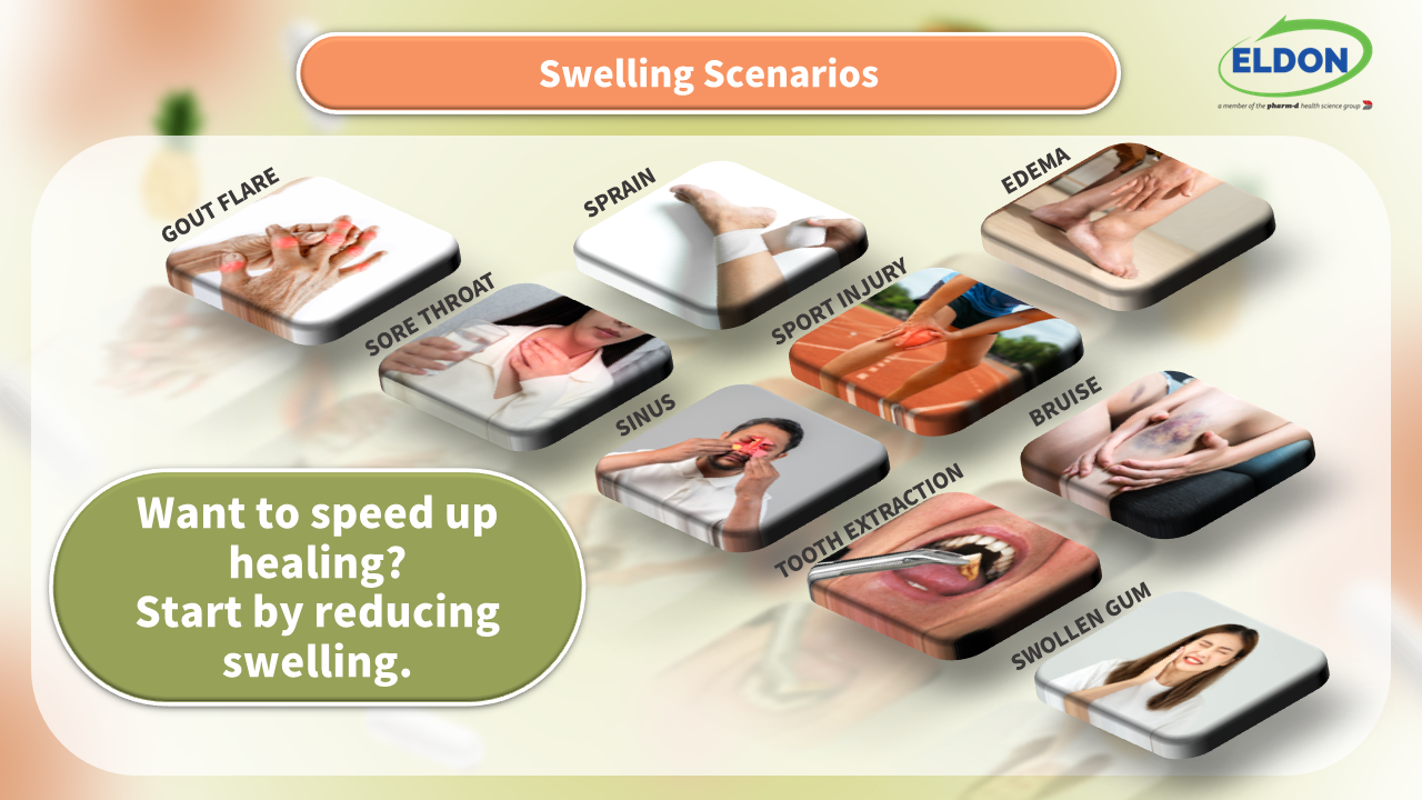 Reduce Swelling & Support Recovery